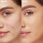 KIKO Milano Full Coverage 2-In-1 Foundation & Concealer mocno kryjący podkład i korektor 2 w 1 NG30 Neutral Gold 30 25ml